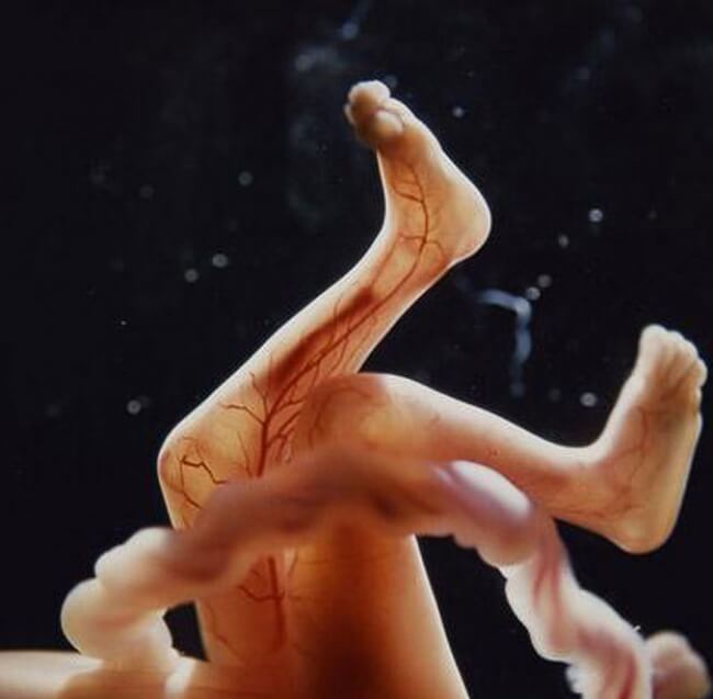 εικόνες εξέλιξης της εγκυμοσύνης